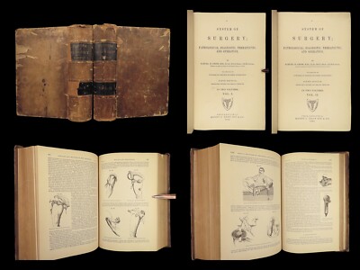 1882 GROSS Anatomy & Surgery System Medicine Pathology Therapy Engraving 2v Set-image